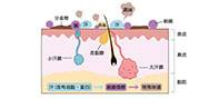 拔掉腋毛会得狐臭吗